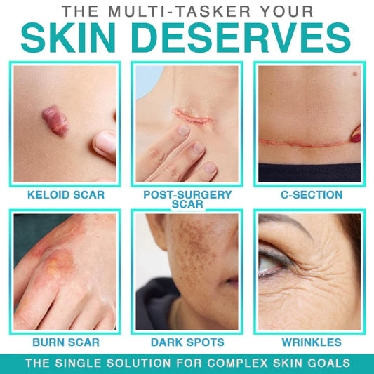 ✨ LAST DAY BUY 1 GET 1 FREE✨𝗖𝗮𝗿𝗲𝗕𝗿𝗲𝗲𝘇𝗲® 3-in-1 Microneedle Care Patch