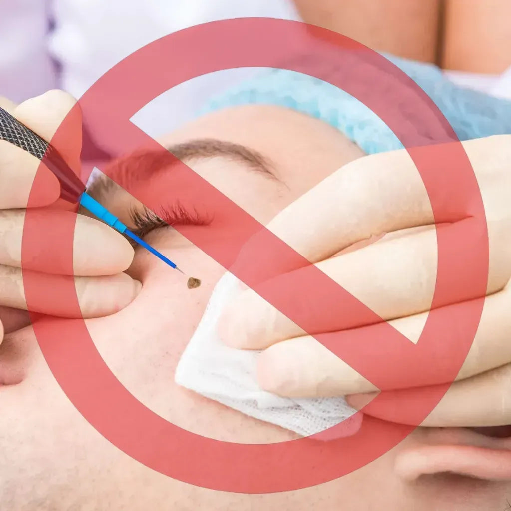 Elycura™ NatureErase: Erase Unwanted Marks in 7 Days Without Surgery, Pain, or $650 Doctor Bills