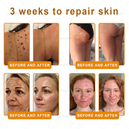 APKAP®Bee venomSkin Restoration Creaml💎💎 Powerful anti-aging solution that targets deepwrinkles,fine lines,sagging skin,and dryness