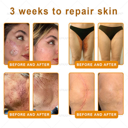 APKAP®Bee venomSkin Restoration Creaml💎💎 Powerful anti-aging solution that targets deepwrinkles,fine lines,sagging skin,and dryness