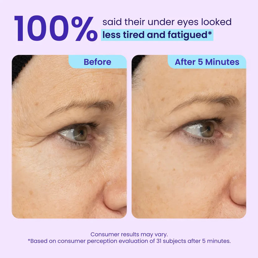 Erase Eye Bags in Minutes — Luxlue Eye Cream Look Refreshed Instantly ⚡Flash Sale🔥