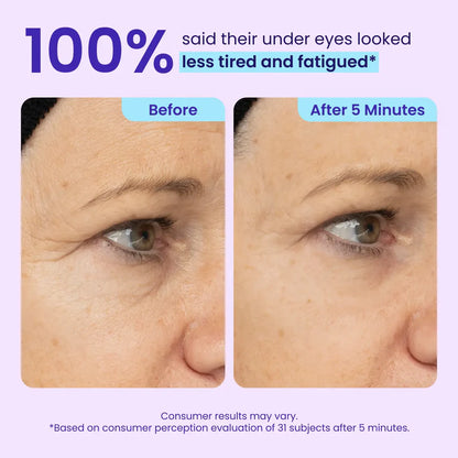 Erase Eye Bags in Minutes — Luxlue Eye Cream Look Refreshed Instantly ⚡Flash Sale🔥