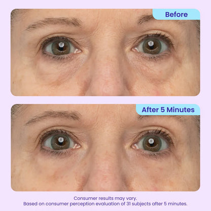 Erase Eye Bags in Minutes — Luxlue Eye Cream Look Refreshed Instantly ⚡Flash Sale🔥