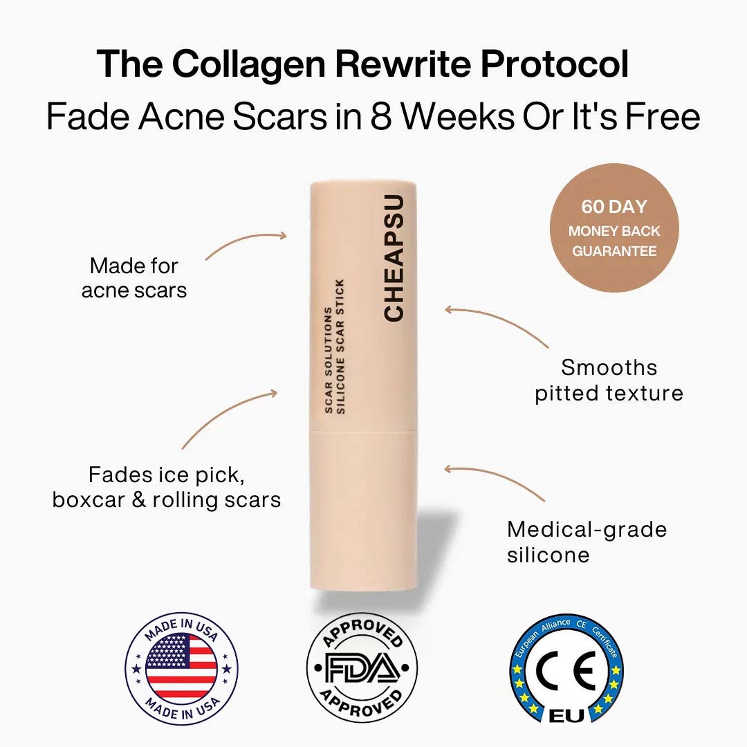 ✨ LAST DAY BUY 1 GET 1 FREE✨Cheapsu™ Clinical Acne Scar Remodeling Stick