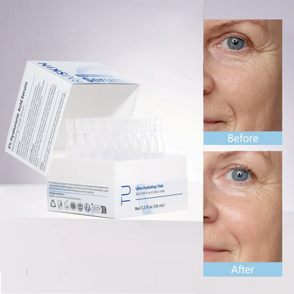 3% Hyaluronic Acid Ultra Hydrating Serum by TurmSkin