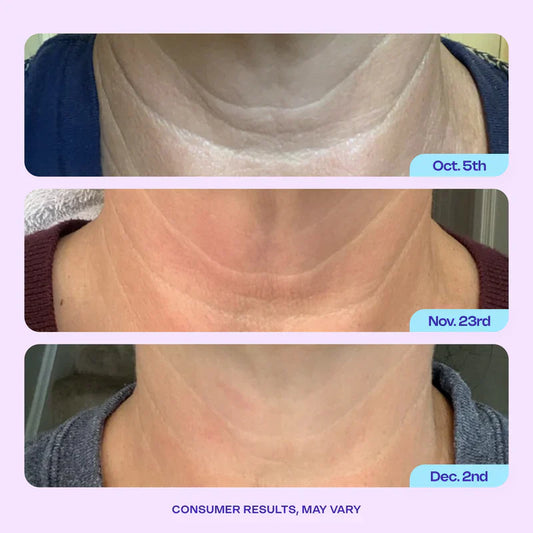 Miracle Neck Cream for "Tech Neck" & "Turkey Neck", Visibly Firmer, Smoother-Looking Skin in 4–8 Weeks