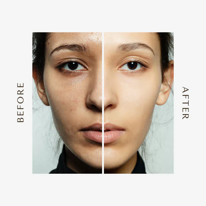 GLOW COMBO SET- 🔥Limited Time Exclusive Offer