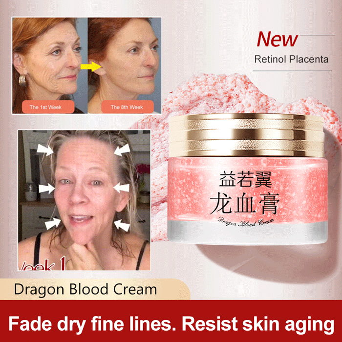 2025 NEW DRAGONS BLOOD EASY CREAM (BUY 3 GET 5 FREE)