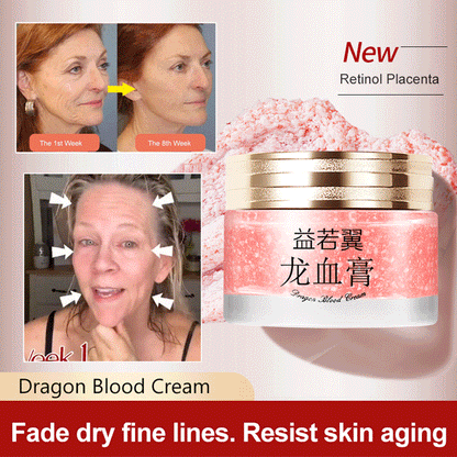 2025 NEW DRAGONS BLOOD EASY CREAM (BUY 3 GET 5 FREE)