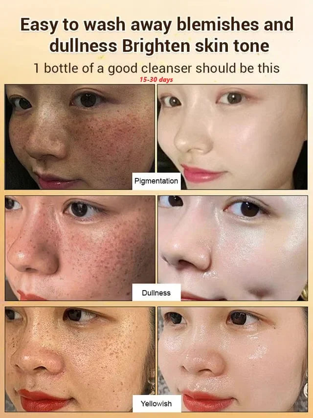 Upgraded anti-freckle essence oil
