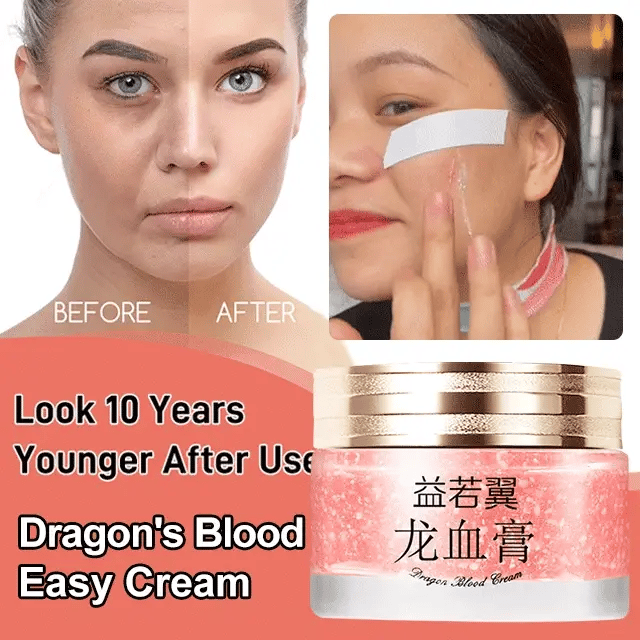 2025 NEW DRAGONS BLOOD EASY CREAM (BUY 3 GET 5 FREE)