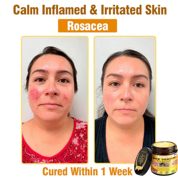 Bee Venom All-in-One Cream US Dermatologist Approved