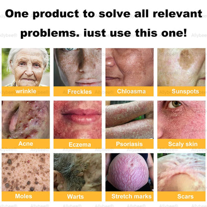 🏆Flash Sale Buy 1 get 1 Free⚡ The "Forbidden" Natural Discovery That Erases Years of Skin Damage & Ends The Daily Battle With Psoriasis, Wrinkles & Chronic Skin Conditions