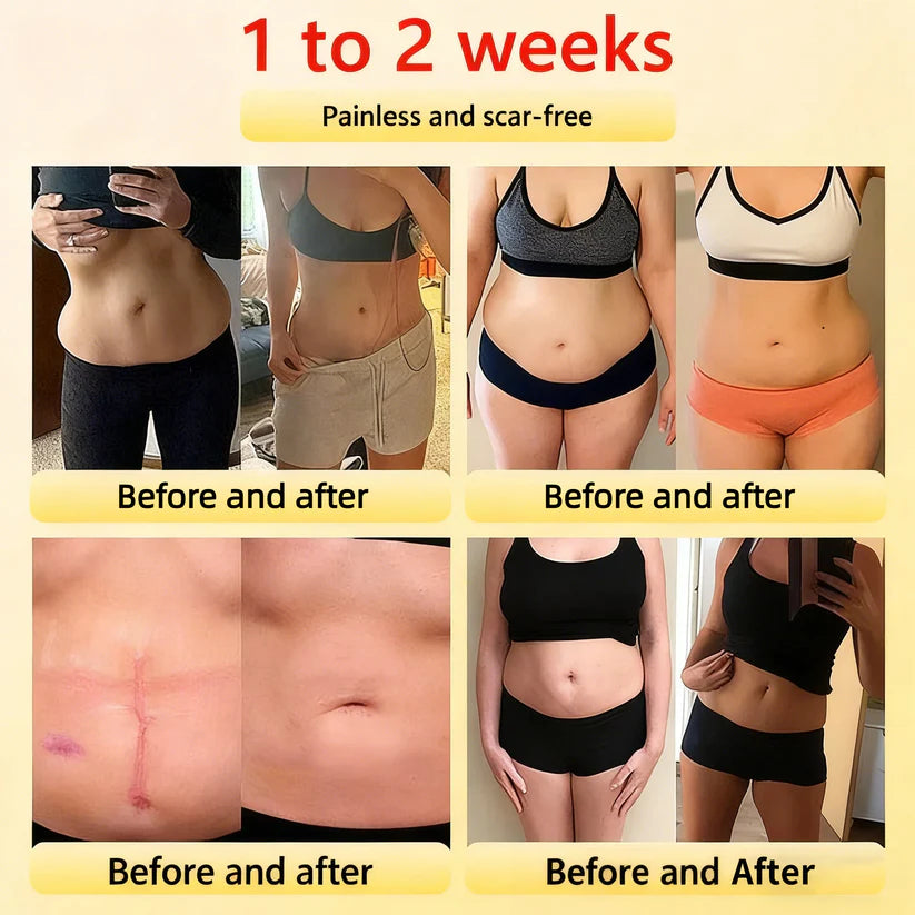 🎉 Limited-time offer – huge discount! 💰 Alisanda™ Self-regulating tourmaline shaping shorts with titanium fiber