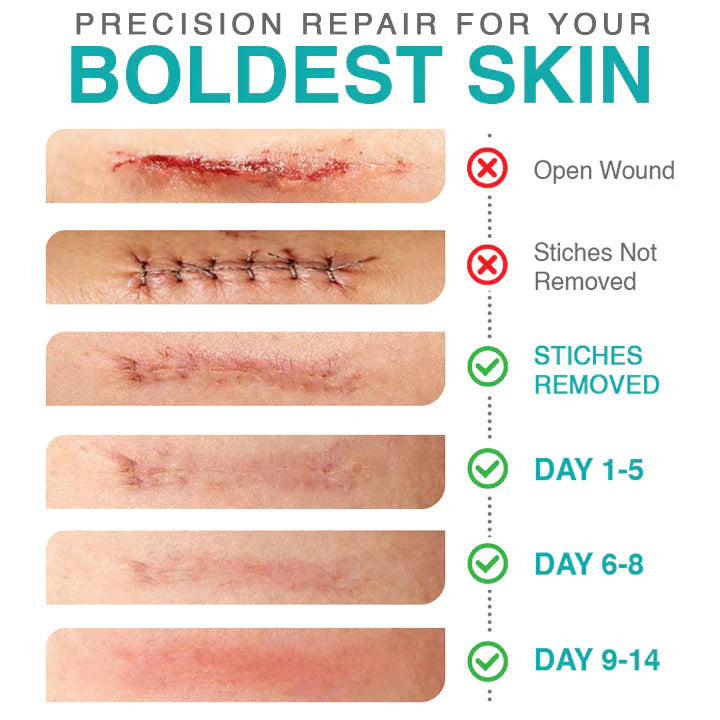 ✨ LAST DAY BUY 1 GET 1 FREE✨𝗖𝗮𝗿𝗲𝗕𝗿𝗲𝗲𝘇𝗲® 3-in-1 Microneedle Care Patch