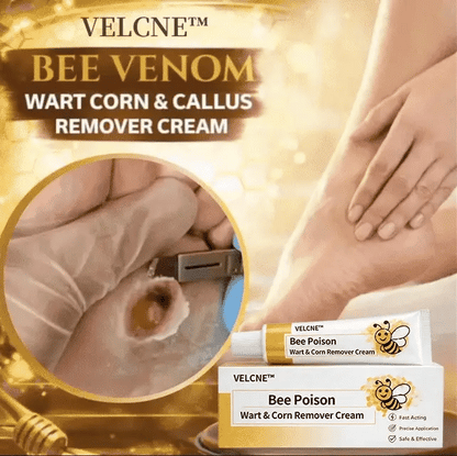 👩‍⚕️Velcne™Bee Poison Wart & Corn Remover Cream