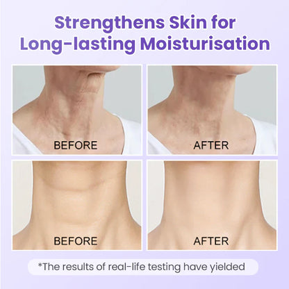 NeckYouth Peptide Anti-Wrinkle Patch