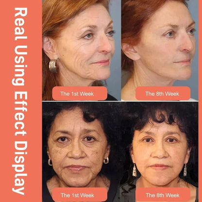 2025 NEW DRAGONS BLOOD EASY CREAM (BUY 3 GET 5 FREE)