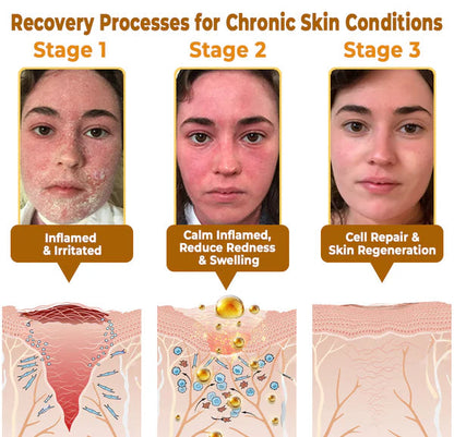 🏆Flash Sale Buy 1 get 1 Free⚡ The "Forbidden" Natural Discovery That Erases Years of Skin Damage & Ends The Daily Battle With Psoriasis, Wrinkles & Chronic Skin Conditions