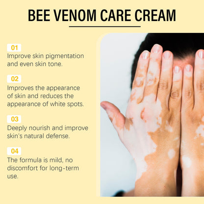 BeeVenom Vitiligo Treatment Cream