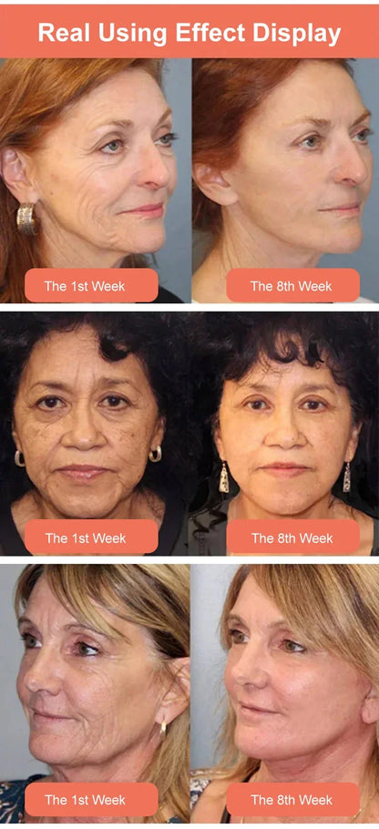 💥2025 NEW DRAGONS BLOOD EASY CREAM