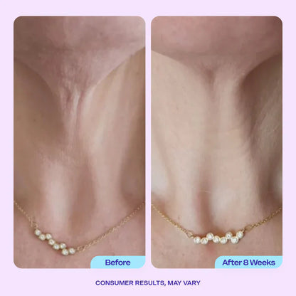 Miracle Neck Cream for "Tech Neck" & "Turkey Neck", Visibly Firmer, Smoother-Looking Skin in 4–8 Weeks