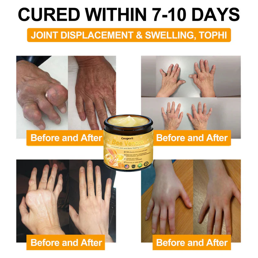 Cougex® Bee Venom Advanced Joint and Bone Healing Cream