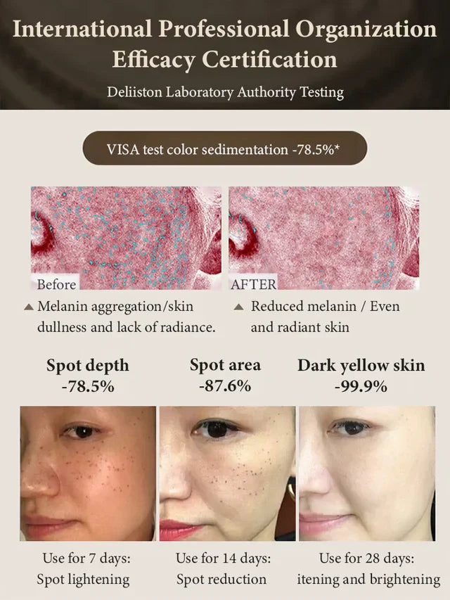 377 WHITENING AND SPOT FADING SERUM