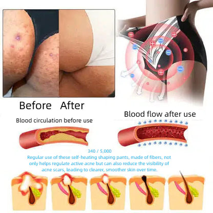 🎉 Limited-time offer – huge discount! 💰 Alisanda™ Self-regulating tourmaline shaping shorts with titanium fiber