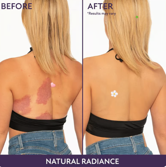 🎉Last Day 🎁 - All Over Complexion Perfector