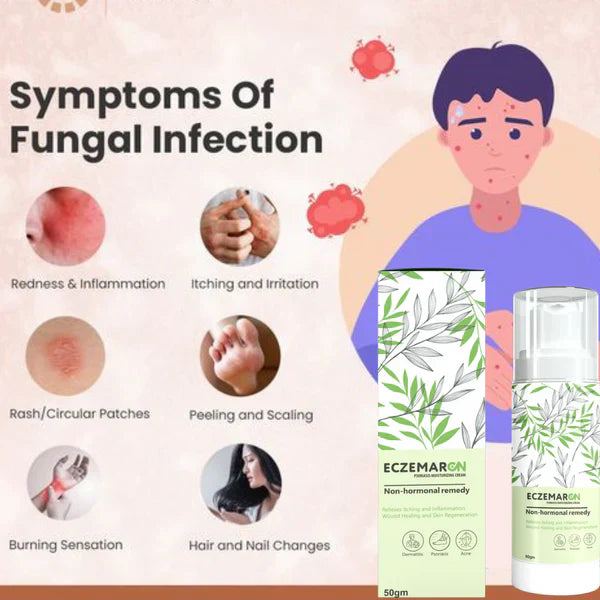 Eczemaron Anti Fungal Cream (BUY 1 GET 1 FREE)