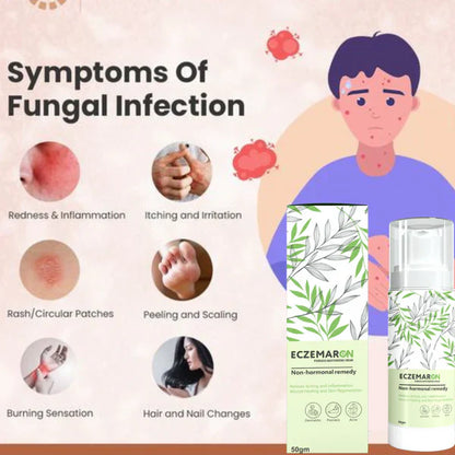 Eczemaron Anti Fungal Cream (BUY 1 GET 1 FREE)
