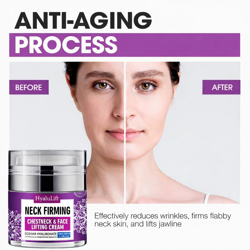 ✨ LAST DAY BUY 1 GET 1 FREE✨HyaluLift™ Face & Neck Firming Cream