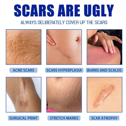✨ LAST DAY BUY 1 GET 1 FREE✨Scar Repair Cream for Men and Women, fade scars and tighten skin in one step