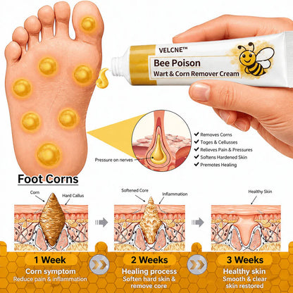👩‍⚕️Velcne™Bee Poison Wart & Corn Remover Cream