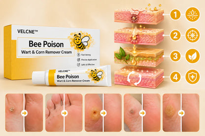 👩‍⚕️Velcne™Bee Poison Wart & Corn Remover Cream